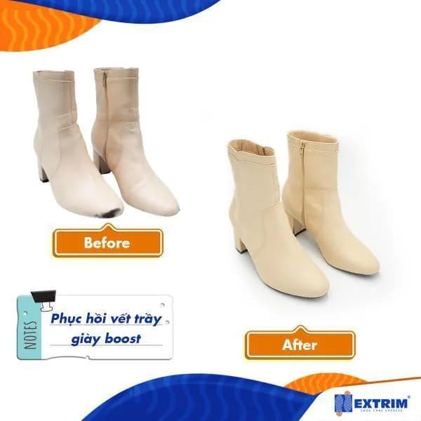 Những Căn Bệnh Giày Thường Gặp Và Cách Phục Hồi Đúng Cách